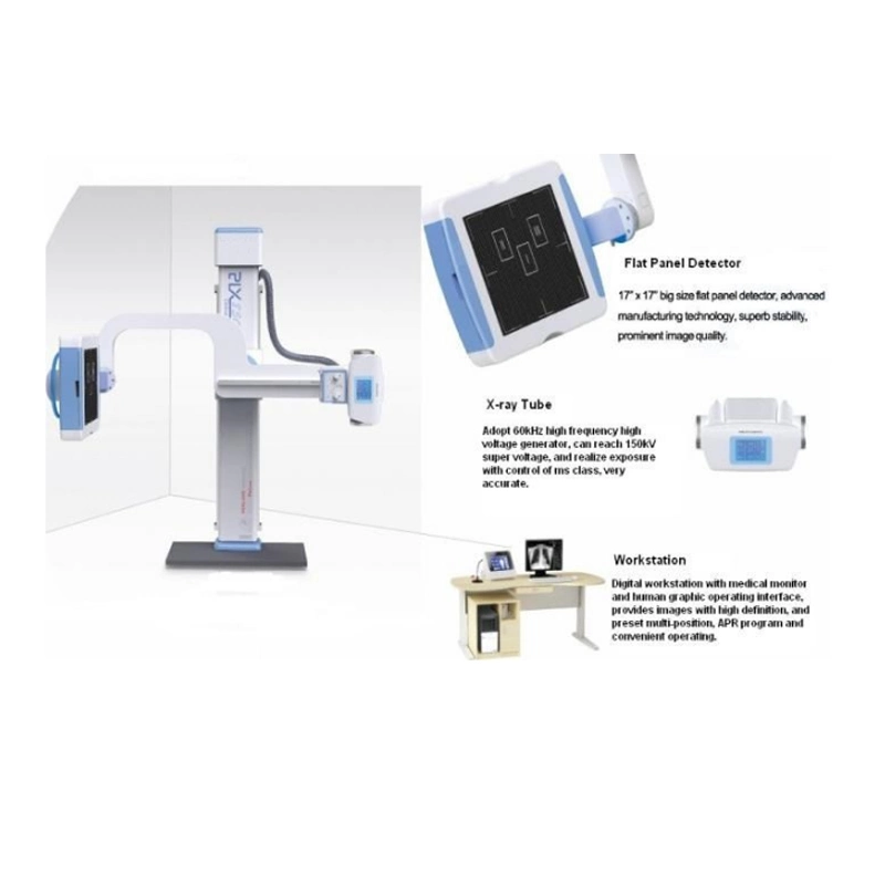 High Image Quality Digital High Frequency U-Arm Radiography System